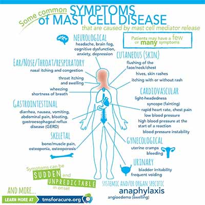 Neurofeedback Tucson AZ Common Symptoms of Mast Cell Disease Neurofeedback Tucson AZ Common Symptoms of Mast Cell Disease